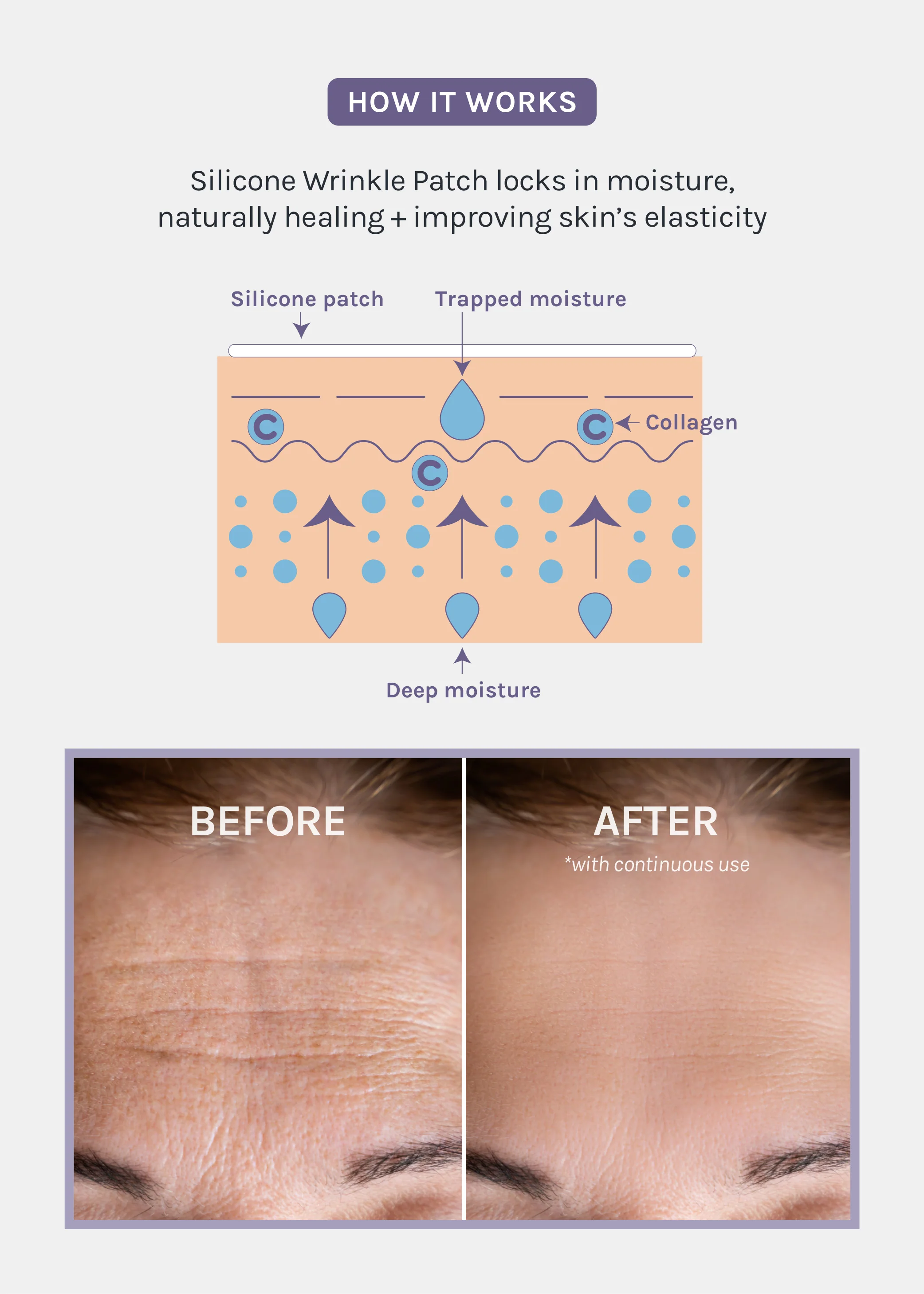 AOA Skin Wrinkle Smoothing Patches – Smile Line - Image 4